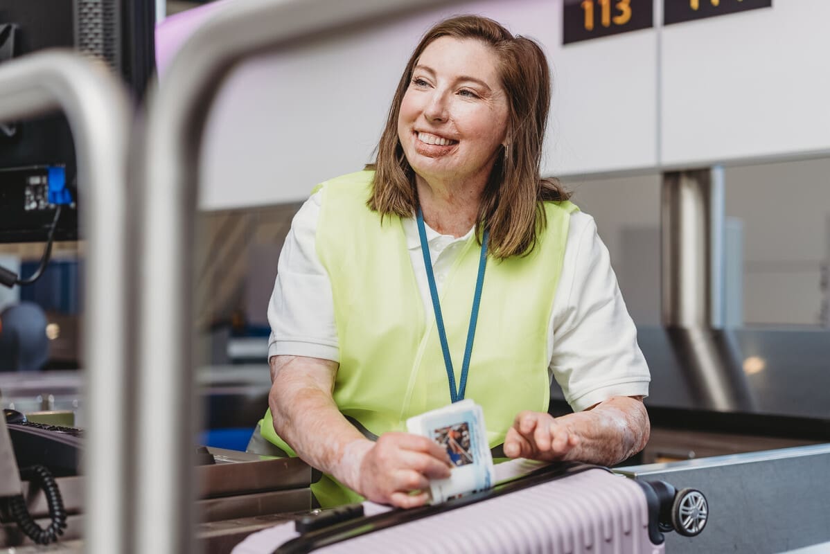Airport worker with scarring and a limb difference tags a suitcase